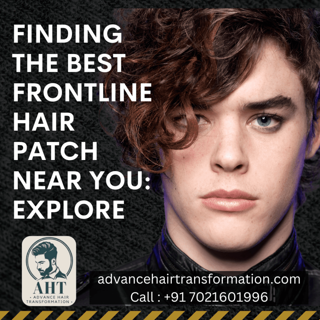 Finding the Best Frontline Hair Patch Near You: Explore Advance Hair Transformation