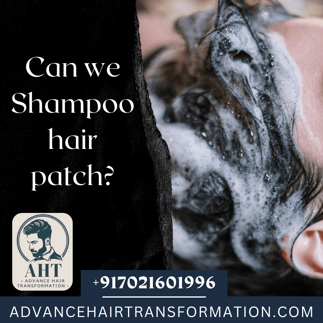 Shampooing a Hair Patch: Guidelines for Effective Maintenance and Care