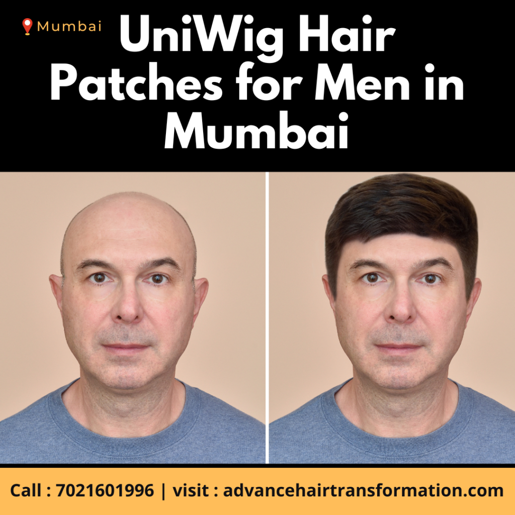 UniWig Hair Patches in Mumbai
